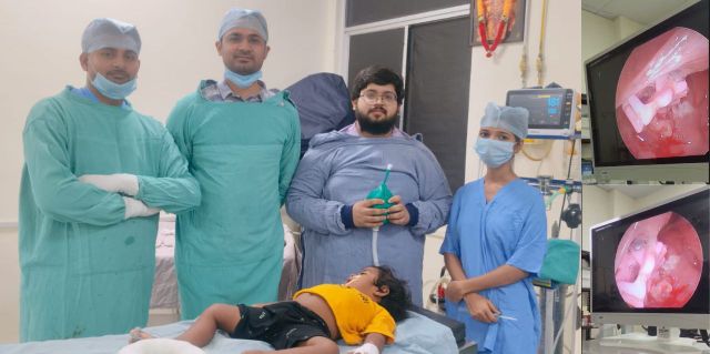 एपेक्स ट्रस्ट हॉस्पिटल में दूरबीन विधि द्वारा 2 वर्षीय मासूम की बची जान, श्वास नली में फंसी हेयर क्लिप का सफल निष्कासन